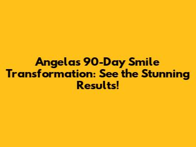 Angela's 90-Day Smile Transformation: See the Stunning Results!